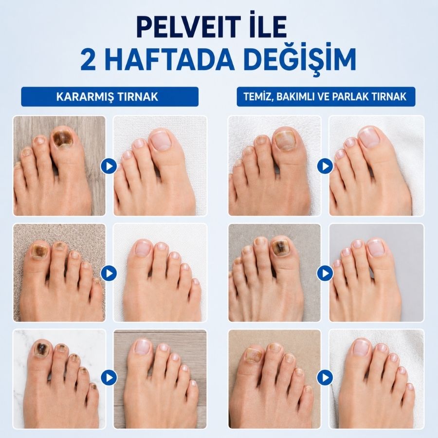 PELVEİT BİTKİSEL TIRNAK YAMASI